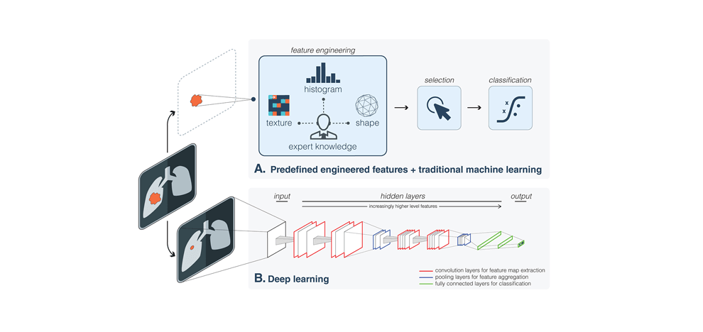 artificial-intelligence-radiology-4